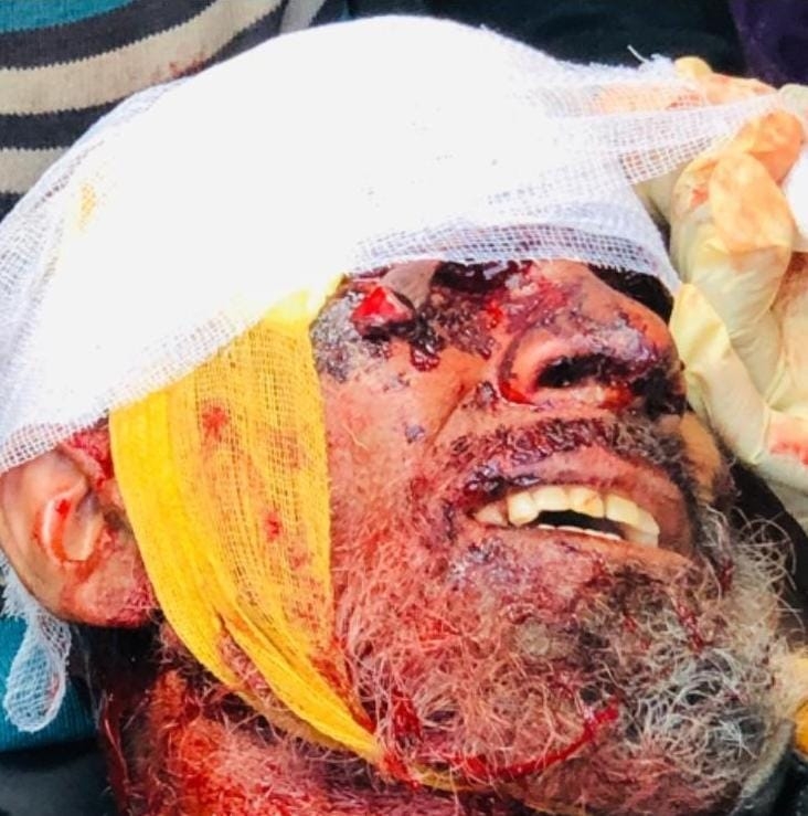Saroori demand compensation for victims of wild animal attacks in Kishtwar